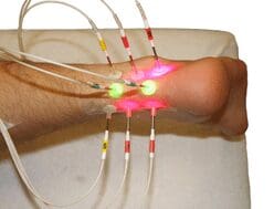 Image 14 Needless Laser Acupuncture